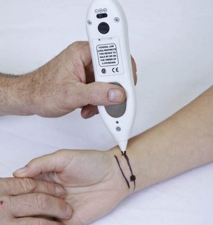 MPS (Micro-Current Point Stimulation) Therapy