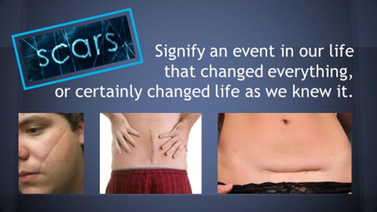 MPS Scar Release Therapy at Olla Terve, Pagosa Springs