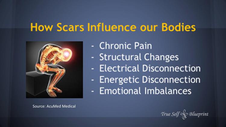 MPS Scar Release Therapy at Olla Terve, Pagosa Springs