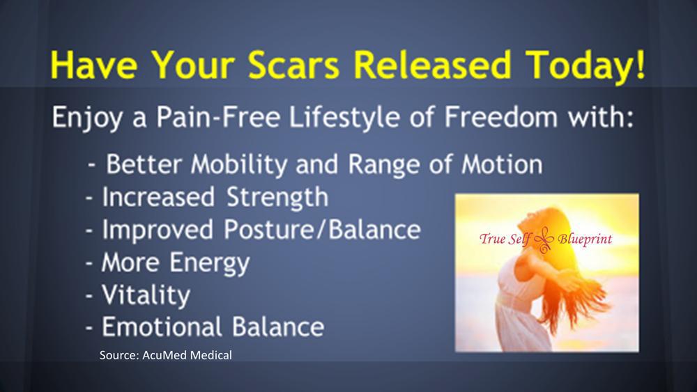 MPS Scar Release Therapy at Olla Terve, Pagosa Springs